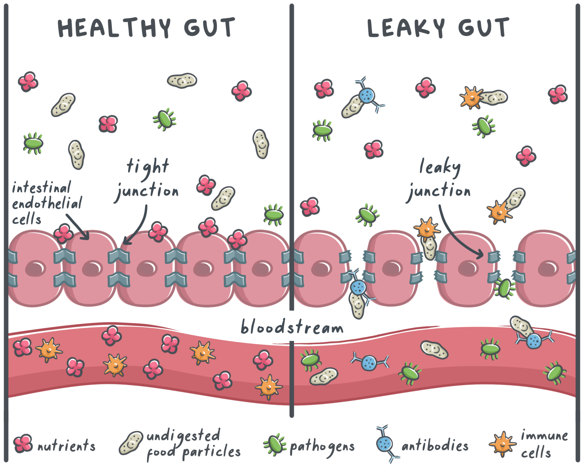 32-healthy-gut-vs-leaky-gut
