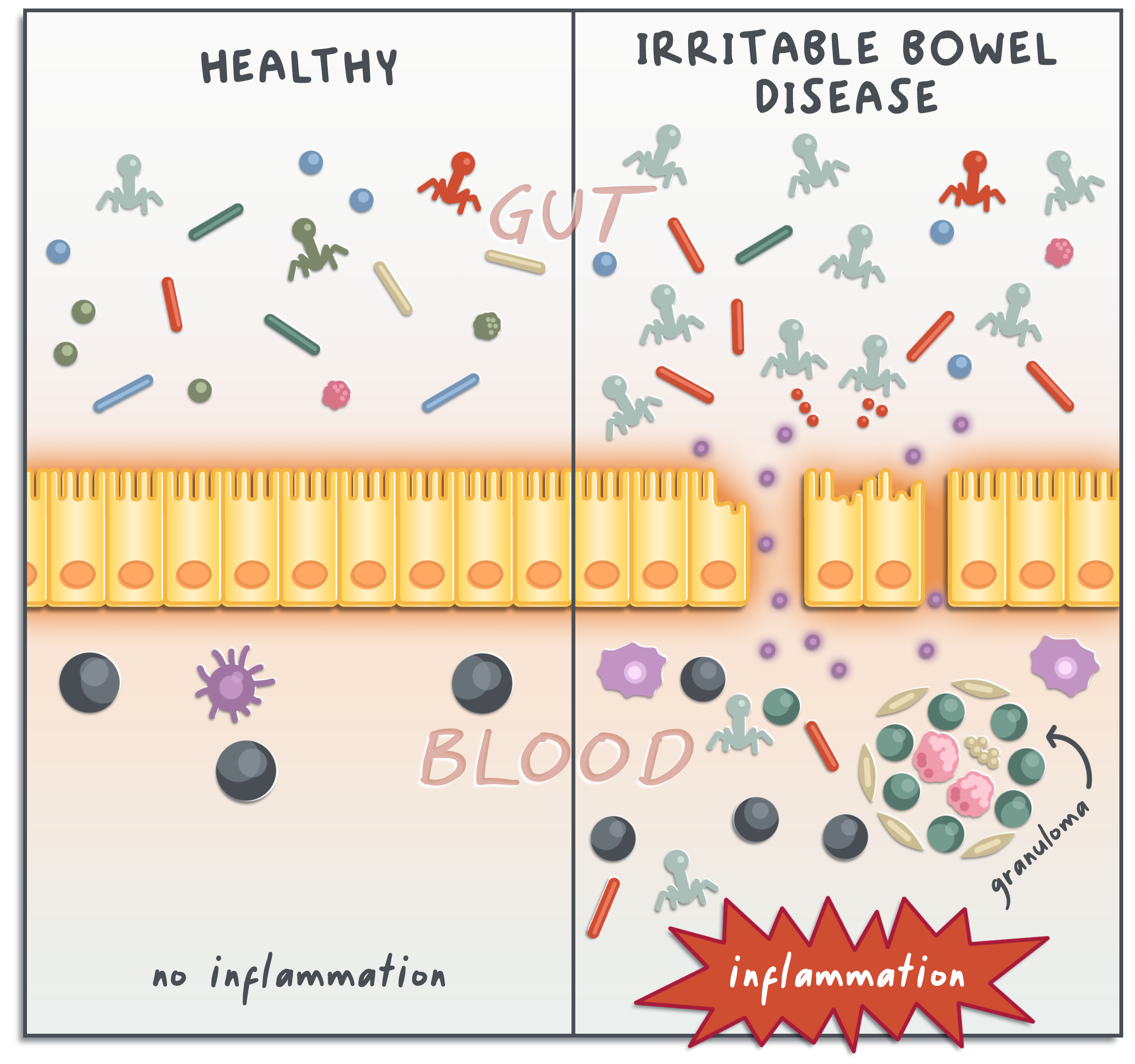 Side-by-side comparison of an unhealthy inflamed gut lining versus a healthy, diverse gut microbiome